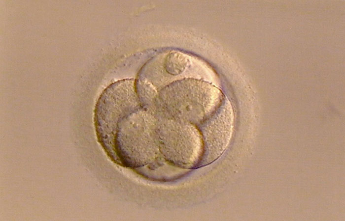 Befruchtete Eizelle | Für die Kinderwunschbehandlung geht von Corona kein Risiko aus | Bild: Getty